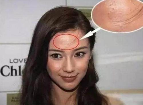 有痘印的明星网红,明星网红的肌肤修复之路