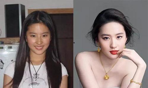 明星网红的整容过程图解,从素颜到蜕变
