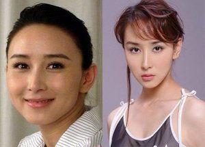 明星网红的整容过程图解,从素颜到蜕变